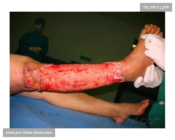 杜埃右大腿受伤与小腿伤无直接关联 疲劳为共同诱因